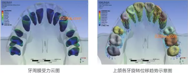 有限元分析法在結(jié)構(gòu)、醫(yī)學(xué)、流體與熱及電場的分析與應(yīng)用