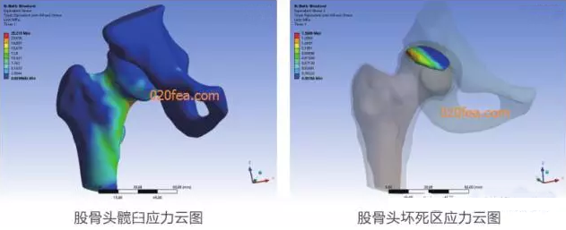 有限元分析法在結(jié)構(gòu)、醫(yī)學(xué)、流體與熱及電場的分析與應(yīng)用